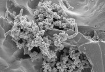Good Bacteria Could Contribute in the Fight Against Pathogens in the Food Processing Environment Salmonella biofilm on stainless steel surface. Photo courtesy of You Zhou (UNL) and Rong Wang (ARS)